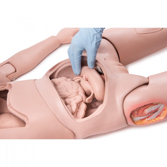 OS110-0651-vnitřní orgány pod abdominální stěnou